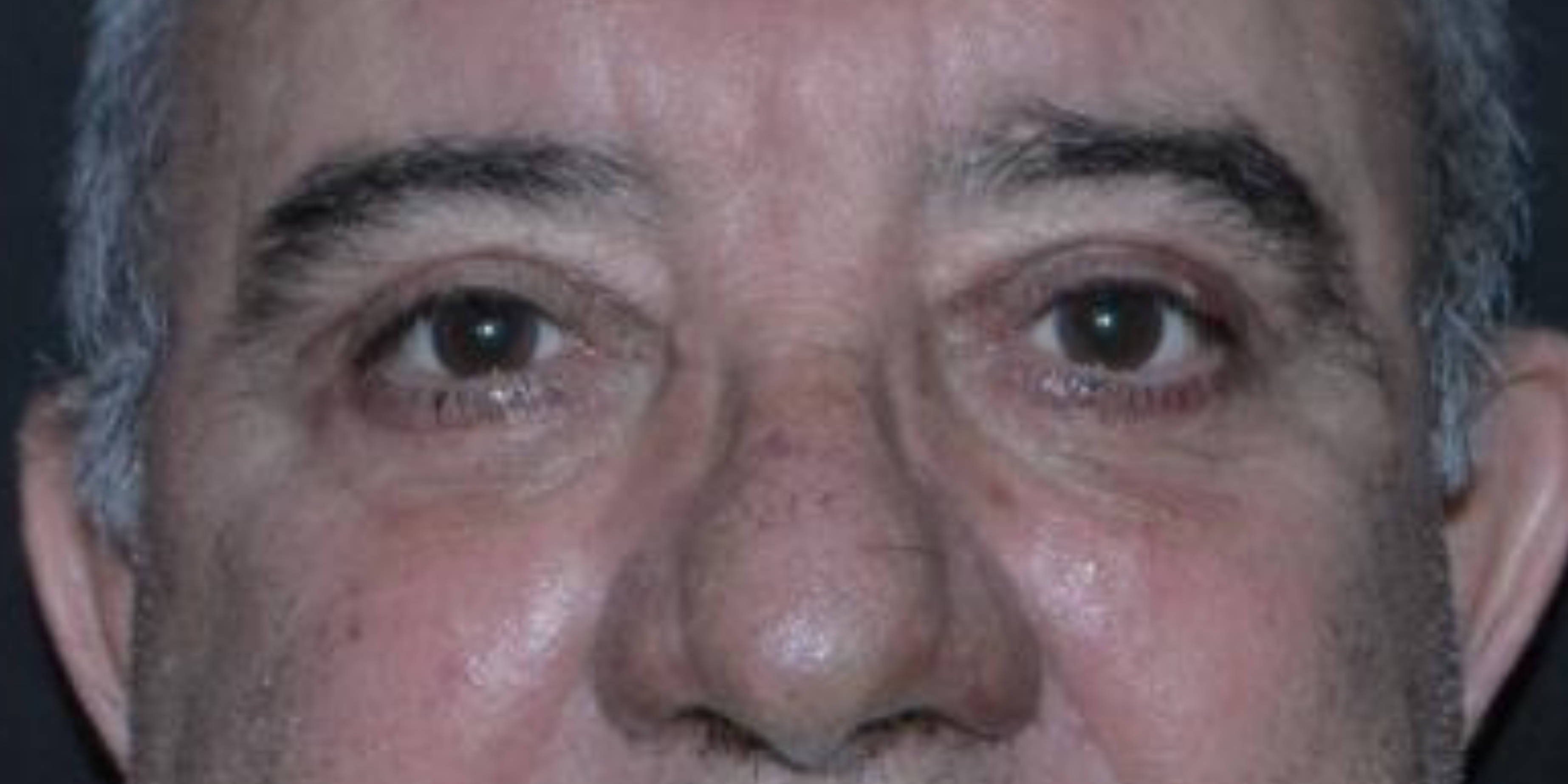 Depois do procedimento